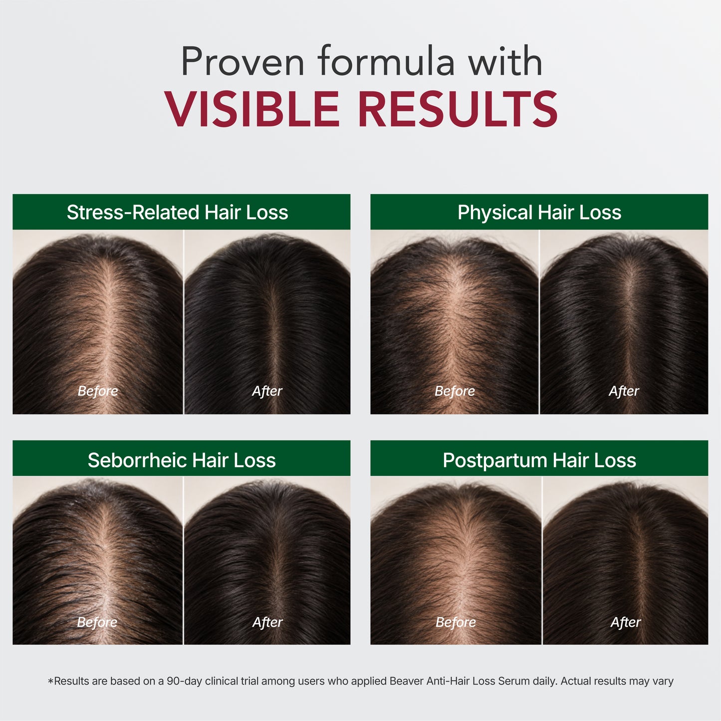 Scalp Care Hair Density Serum 25ml