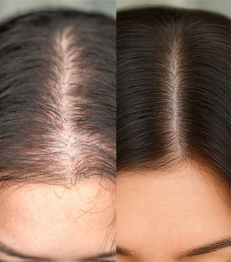 Left Image
