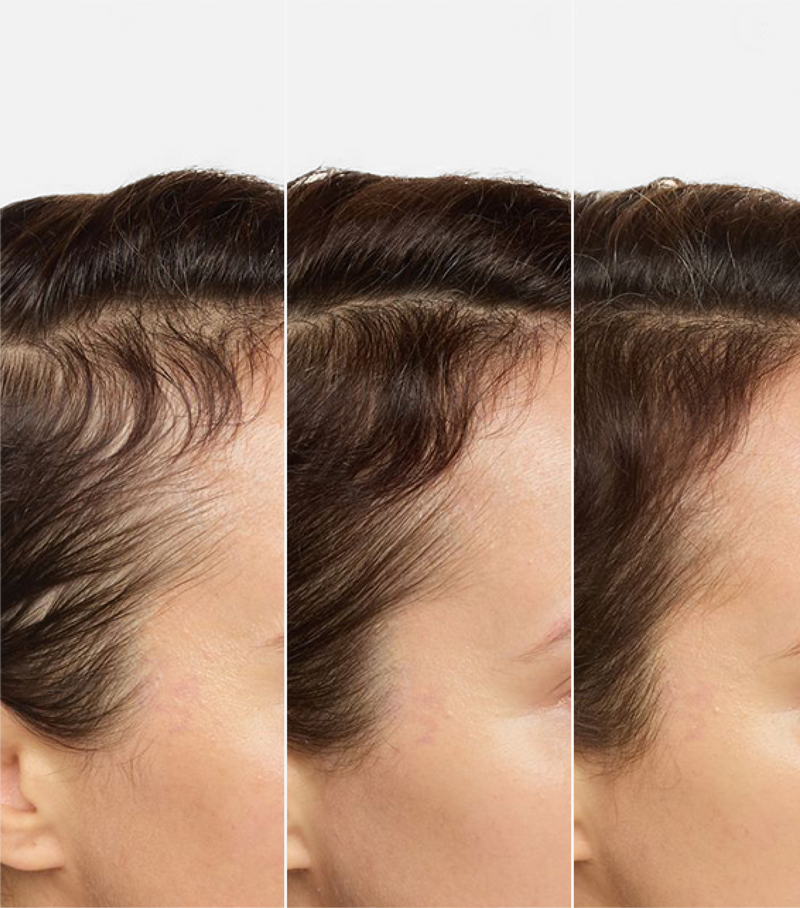 Left Image