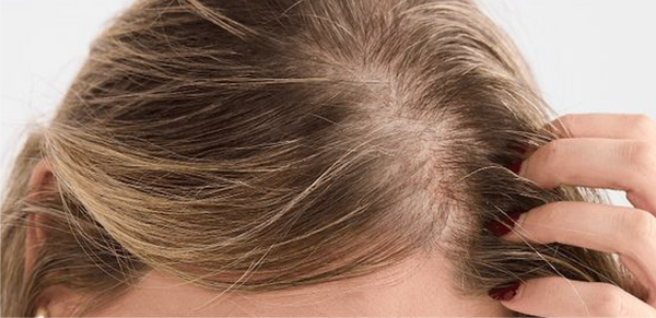 Post-Pregnancy Shedding