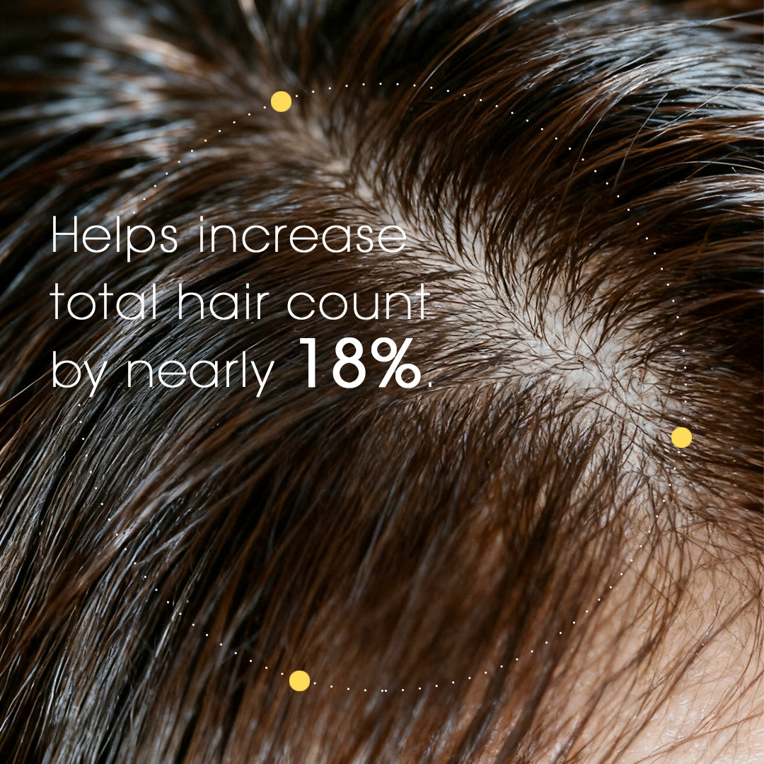 Close-up of hair with text indicating a 18% increase in hair count.